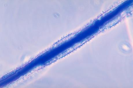 Aspergillus_flavus_01