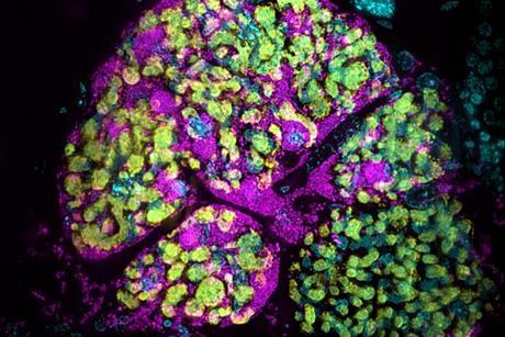 Low-Res_Infected_bacteriome__Ronja_Kruesemer