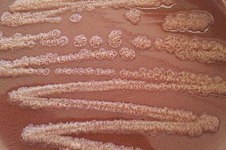 Pseudomonas_stutzeri