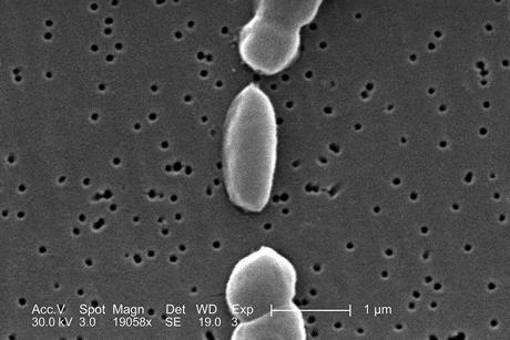Vibrio_parahaemolyticus_01