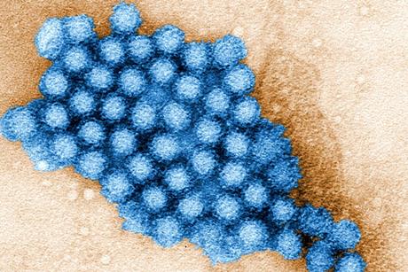 Norovirus