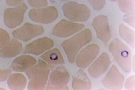 Plasmodium_falciparum_in_Red_Blood_Cells