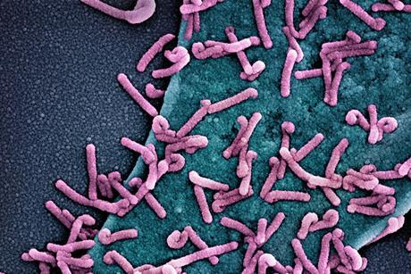 Marburg_virus_outbreak