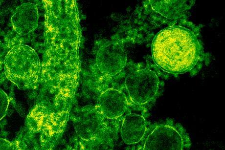 pexels-cdc-library-3992943 (2)