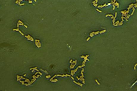 Escherichia_coli_(257_06)_Gramnegative_rods (1)