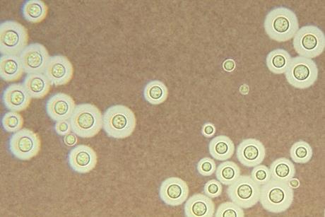 Cryptococcus_neoformans_using_a_light_India_ink_staining_preparation_PHIL_3771_lores