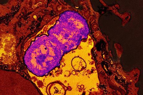 Klebsiella_pneumoniae_bacteria_with_a_human_neutrophil_(red)_containing_ingested_Klebsiella_pneumoniae_(purple)