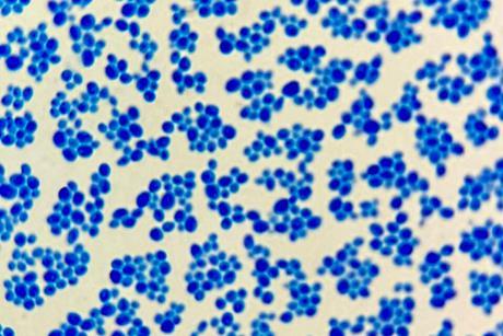 Saccharomyces_cerevisiae_Loeffler's_Methylene_Blue_Staining