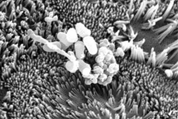 Propionibacterium_freudenreichii_CIRM-BIA_129