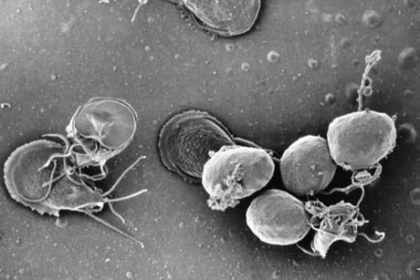 Giardia_lamblia_culture