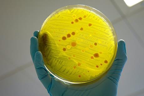 Antimicrobial_resistance