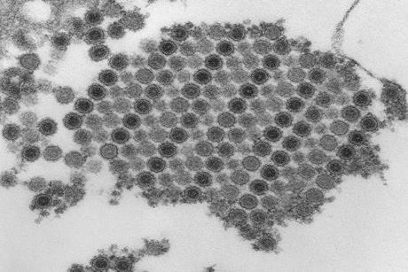 960px-Chikungunya_virus_particles-PHIL-17369
