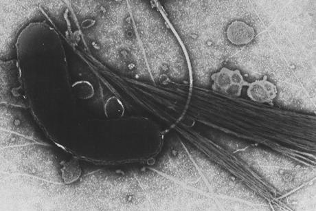 960px-Vibrio_cholerae