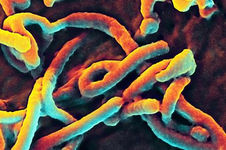 Ebola_Virus_(5)