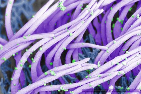 Influenza_A_virions_on_cilia_human_nasal_epithelium_SEM_high_magnification