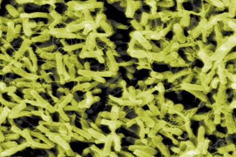 ClostridiumDifficile