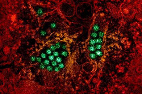 Dengue_Virus_Particles_(53231045112)