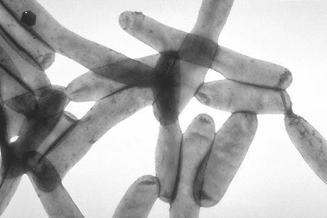 Legionella_pneumophila_01 (1)