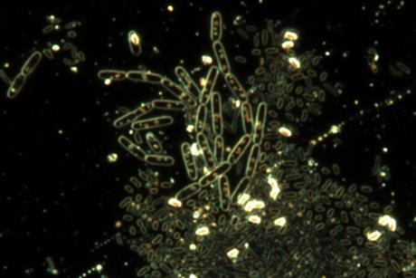 Spores_of_Bacillus_subtilis.tif