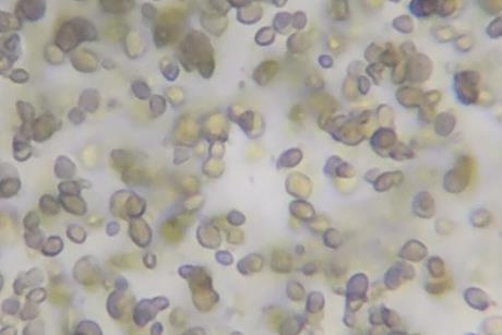 Microscope_view_of_Candida_albicans_20200228_134207_04