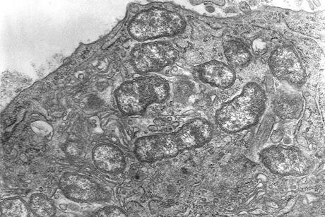 Orientia_tsutsugamushi