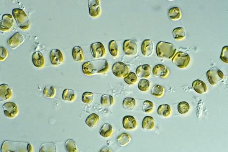 CSIRO_ScienceImage_4905_diatom