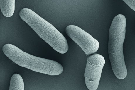 Corynebacterium_glutamicum_(VAAM)