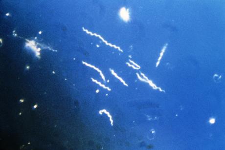 Borrelia_burgdorferi_(CDC-PHIL_-6631)_lores