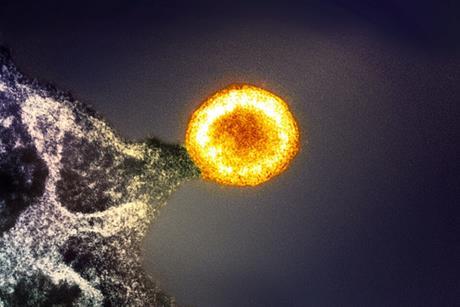 HIV-1_Virus_Particle_(52532147267)