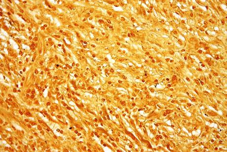 Treponema_pallidum_-_very_high_mag