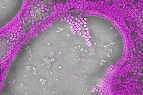 Low-Res_bacteria