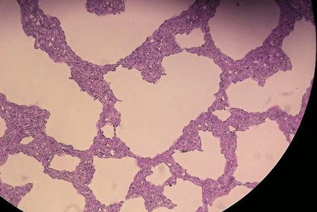 Rhodotorula_mucilaginosa_400x_img430