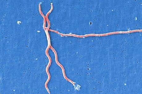 Lyme_disease_parasite_Borrelia_burgdorferi