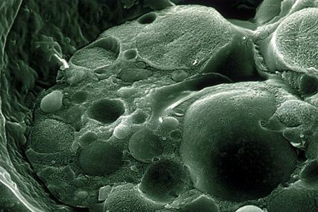 CSIRO_ScienceImage_1168_Scanning_Electron_Micrograph_of_Chytrid_Fungus