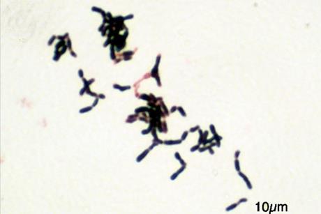 Bifidobacterium_adolescentis_Gram (1)