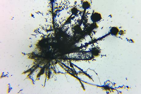 Microscope_view_of_Aspergillus_flavus_fungus_14