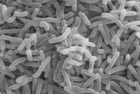 Cholera_bacteria_SEM