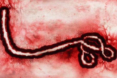 The_zoomed_out_ebolavirus_of_the_DRC_2026_OUTBREAK.webp