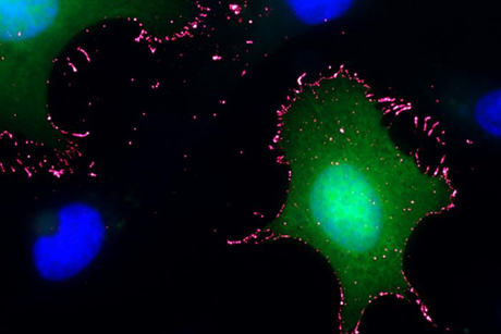 Low-Res_ANDV(green)_PCDH1(pink) 1 1