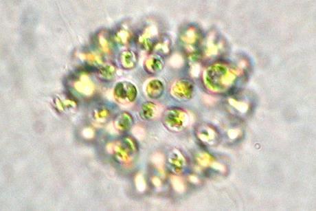 Microcystis_aeruginosa