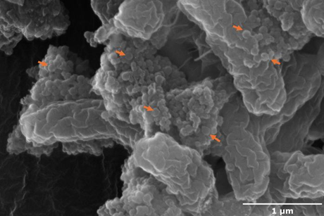 Low-Res_Nanoplastics on bacteria