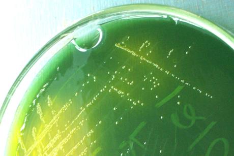 Vibrio_cholerae_on_TCBS_agar