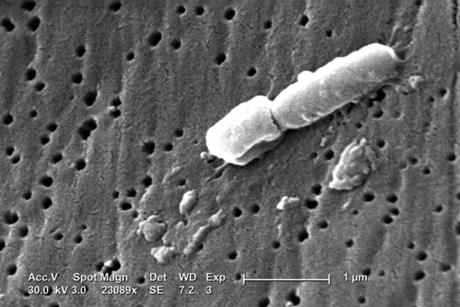 Klebsiella-pneumoniae