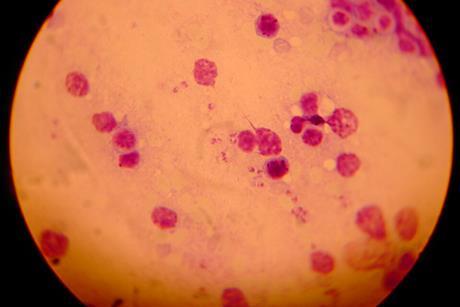 Leishmania_(02)