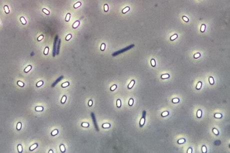 Low-Res_Endospore Bacillus (CCA-SA 3.0 Geoman3)