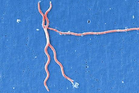 Lyme_disease_parasite_Borrelia_burgdorferi