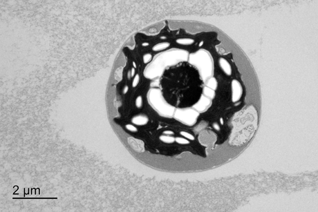 Veac102fS2Bbtm-TEM_of_Chlamydomonas_reinhardtii_CC-3268_cells