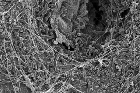 Blokesch lab SEM2