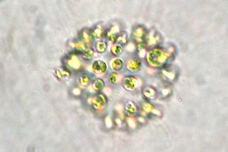 Microcystis_aeruginosa