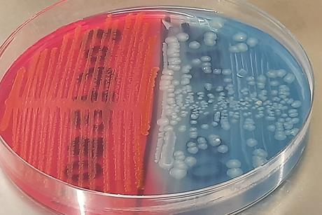 Lactose-fermenting_(LF)_strain_and_non-lactose_fermenting(NLF)_strain_of_E._coli_colony_morphology_on_CLED_medium